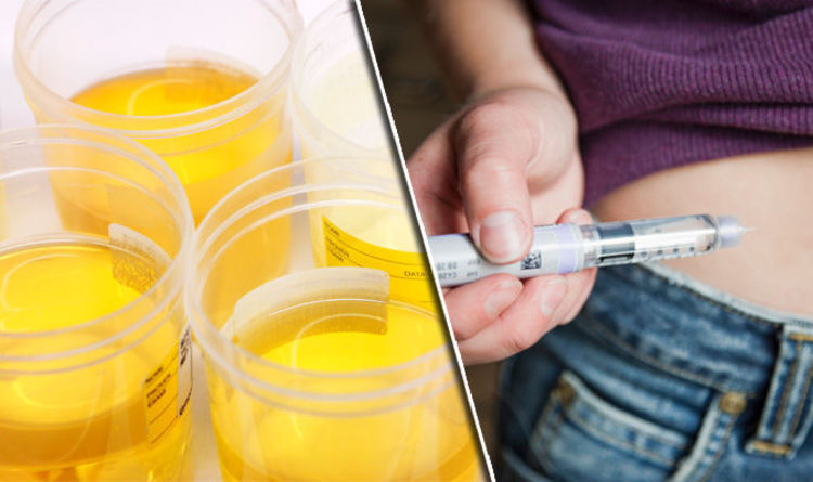 7 Possible Causes Of Unpleasant Smell In Urine