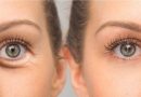Eye Bag Removal Singapore: How much does it Cost to Remove Eye Bags?