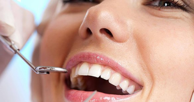 Dental Implants Tampa