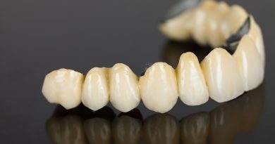 dental crown and bridge solutions