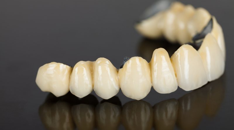 dental crown and bridge solutions