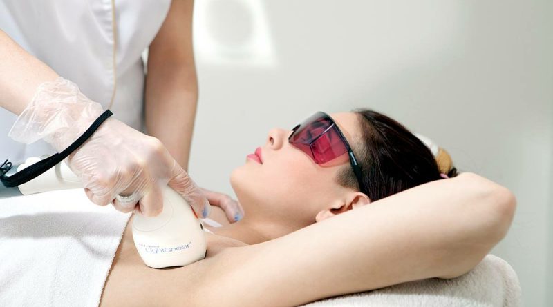 safe laser hair removal