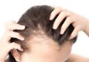 hair loss clinic in Juhu