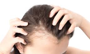 hair loss clinic in Juhu