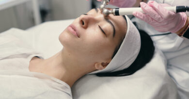 Melasma Treatment Ilford