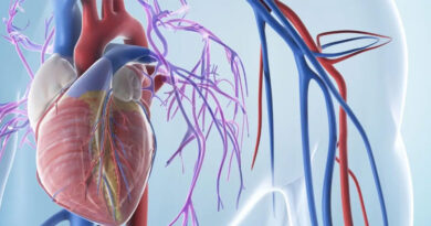 CABG Bypass