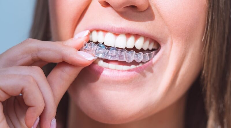 invisalign cost london