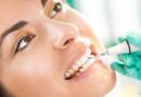 Teeth Cleaning
