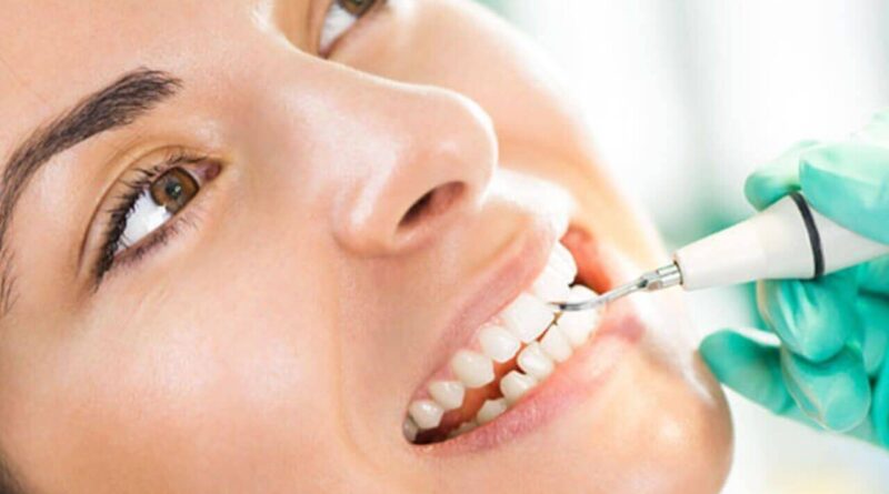 Teeth Cleaning