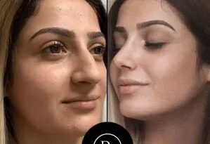 Best Aesthetic Clinic in Dubai