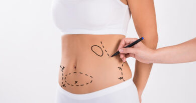 Liposuction in Dubai