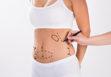 Liposuction in Dubai