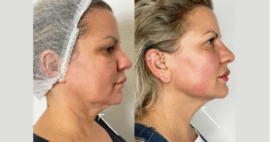 Best Doctors in Dubai for Natural Results