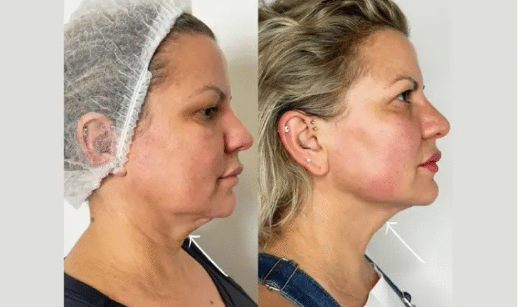Best Doctors in Dubai for Natural Results