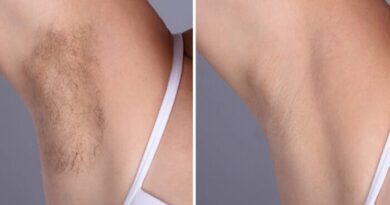 Laser hair removal in Dubai